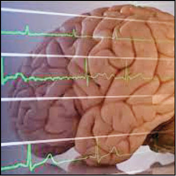 مرگ مغزی چگونه رخ می‌دهد؟