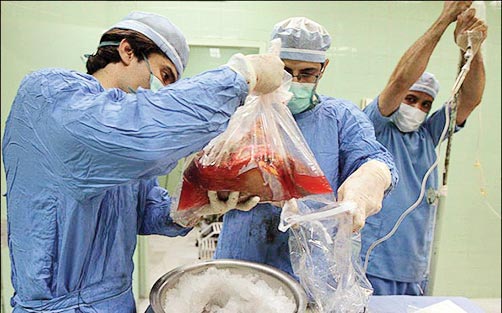 شرایط پیکر اهدا‌کننده پس از مرگ