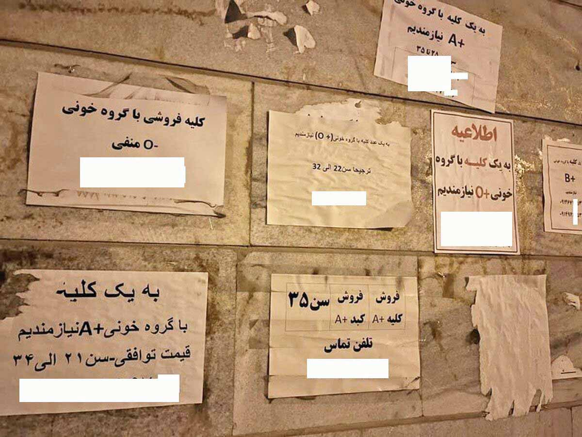 درحالی‌که خانواده بیماران مرگ مغزی اعضای بدن عزیزشان را اهدا می‌کنند، عده‌ای نیز اعضای بدن خود را می‌فروشند