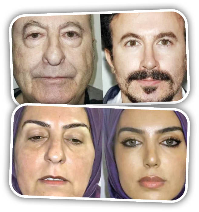 شهرت پلاستیکی